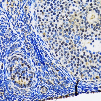 p53 Antibody