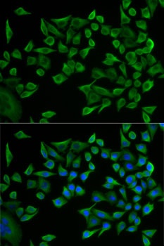 WARS Antibody