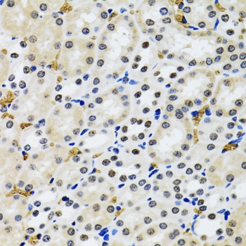 53BP1 Antibody