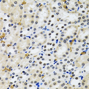 TP53BP1 Antibody