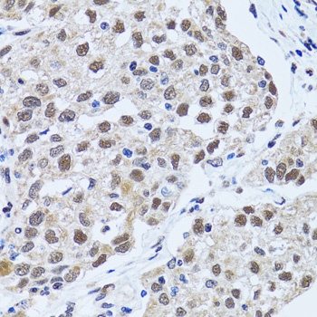 TP53BP1 Antibody