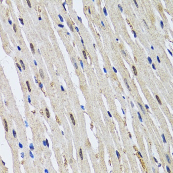 TP53BP1 Antibody