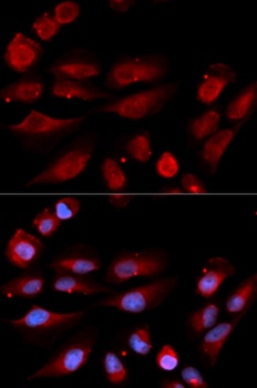 53BP1 Antibody