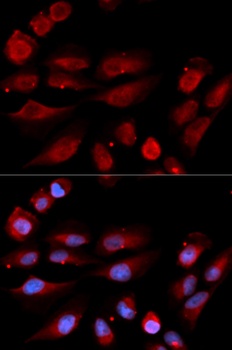 TP53BP1 Antibody