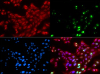 TP53BP1 Antibody