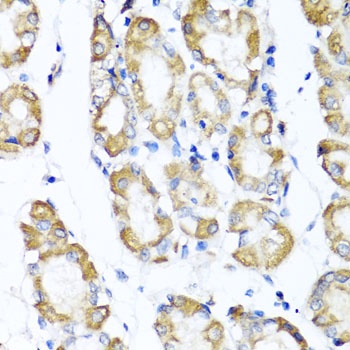 ST6GAL1 Antibody