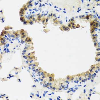 ST6GAL1 Antibody