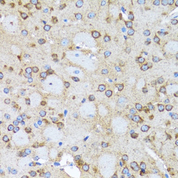 ACTR2 Antibody