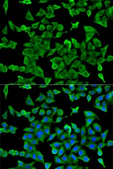 ACTR2 Antibody