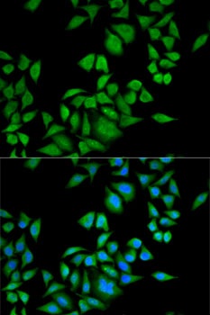 QDPR Antibody