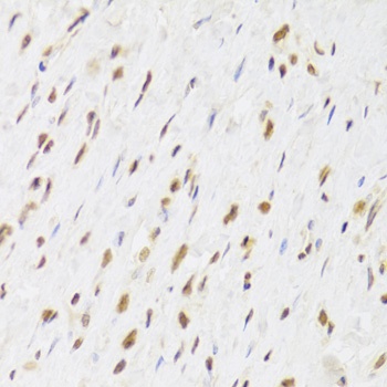 RUVBL1 Antibody