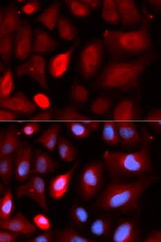 PDLIM5 Antibody