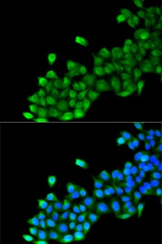 GC Antibody