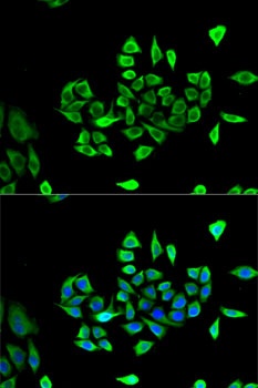 CLCN5 Antibody