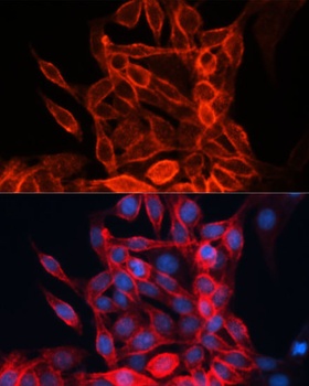 SLC3A2 Antibody