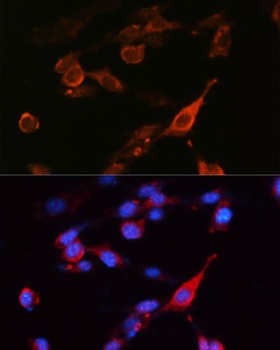 SLC3A2 Antibody