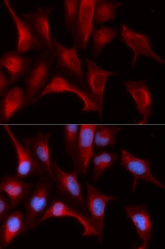 PSMB4 Antibody