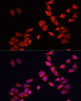 BNIP3 Antibody