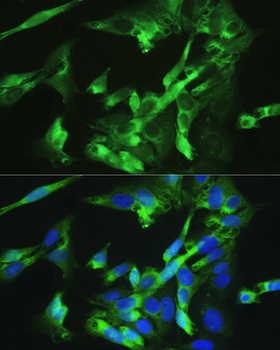BMPR2 Antibody