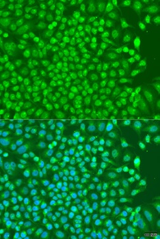 NKX2-5 Antibody