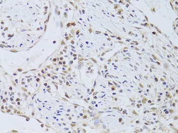 FKBP4 Antibody