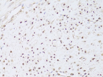 FKBP4 Antibody