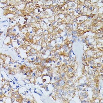 ECE1 Antibody