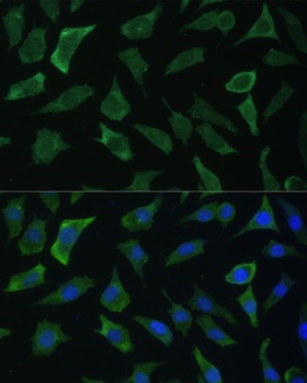 ECE1 Antibody