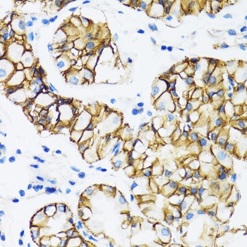 CTNNA1 Antibody