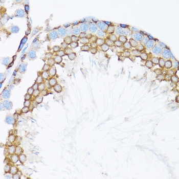 CTNNA1 Antibody