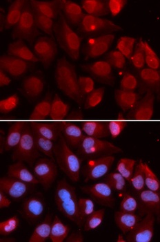 RAG2 Antibody