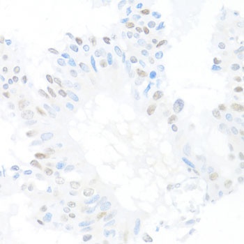 CREM Antibody