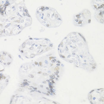 CREM Antibody