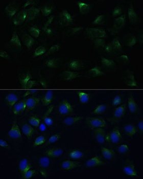 PGRMC1 Antibody