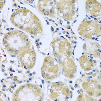 FBXL5 Antibody