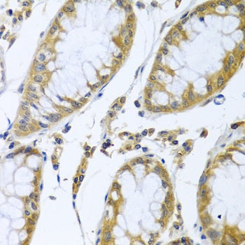 FBXL5 Antibody