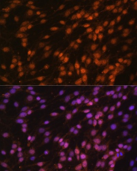 FUBP1 Antibody