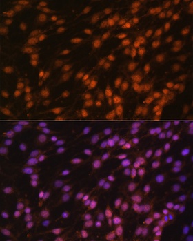 FUBP1 Antibody