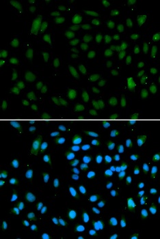 WHSC1L1 Antibody