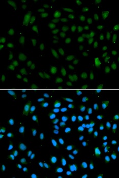 NSD3 Antibody