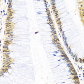 SKIV2L2 Antibody