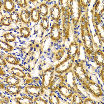 WNK3 Antibody