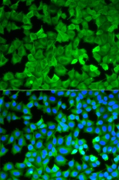 ASNS Antibody