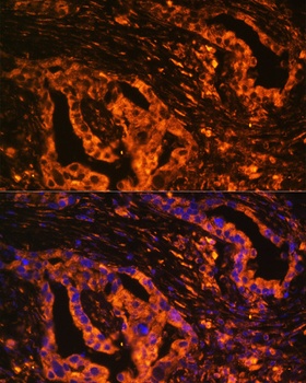 SCNN1A Antibody