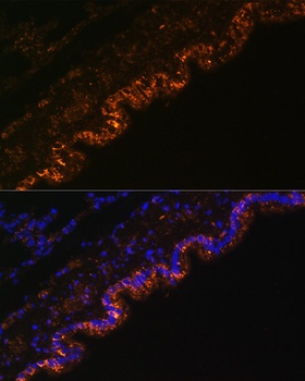 SCNN1A Antibody