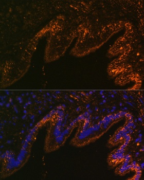 SCNN1A Antibody