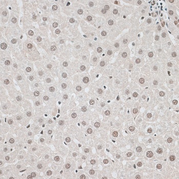 CBX6 Antibody