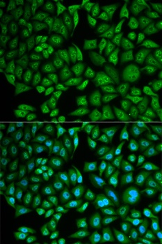 CTSA Antibody