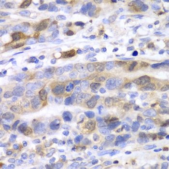 UBE2C Antibody