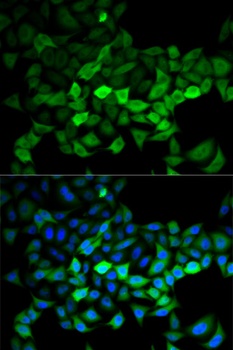 UBE2C Antibody